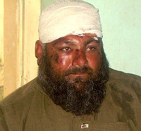 Injured man