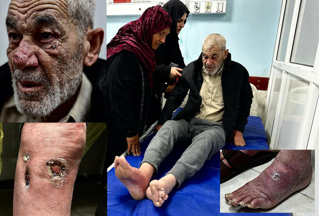 قربانی شکنجه و توحش صهیونیستها