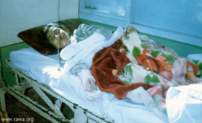 Muska, an election worker who burned herself after a rape attempt on her by a UN local driver