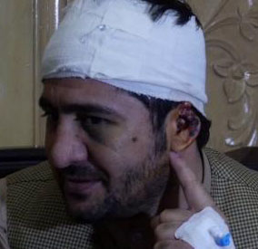 آصف مهمند
